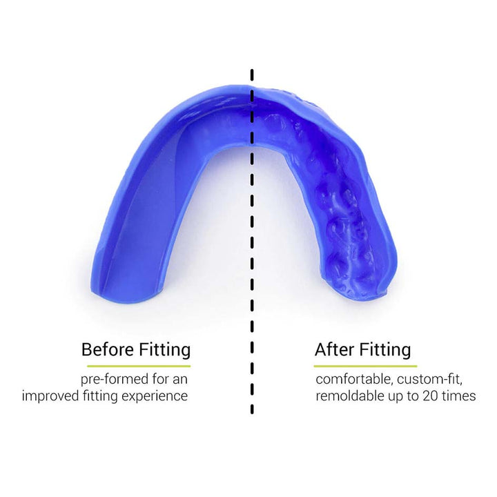 SISU 3D Custom Fit Mouth Guard